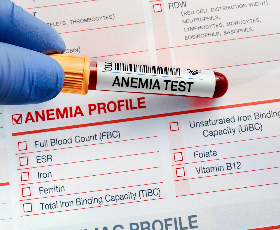 anemia